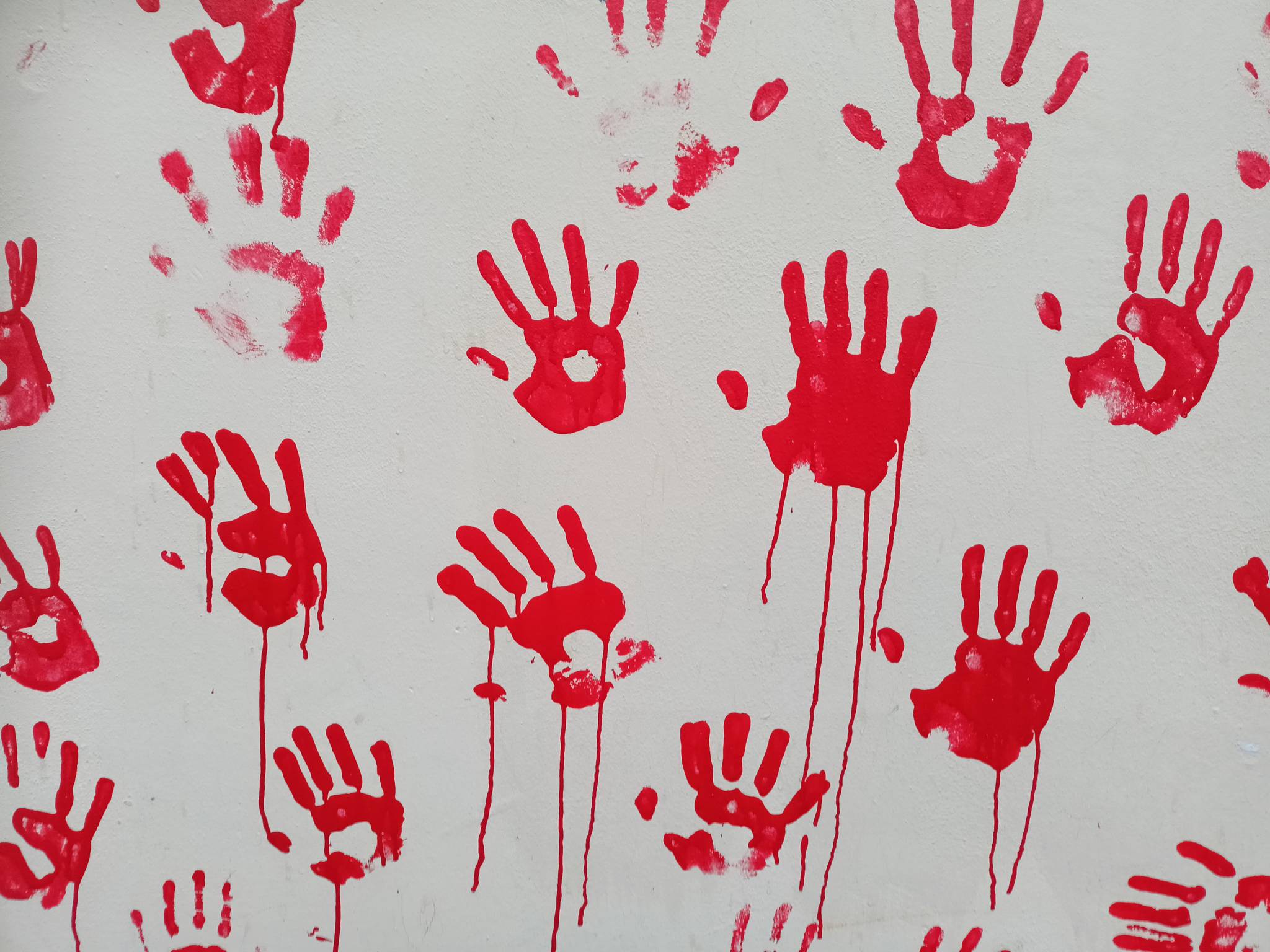 Pisa students&mdash;Bleeding hands